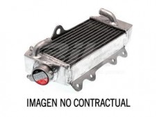 Radiador de aluminio moldeado standard lado derecho